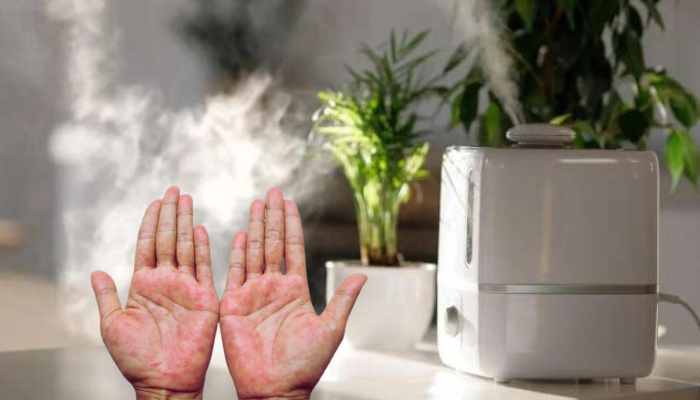 do air purifiers help with eczema