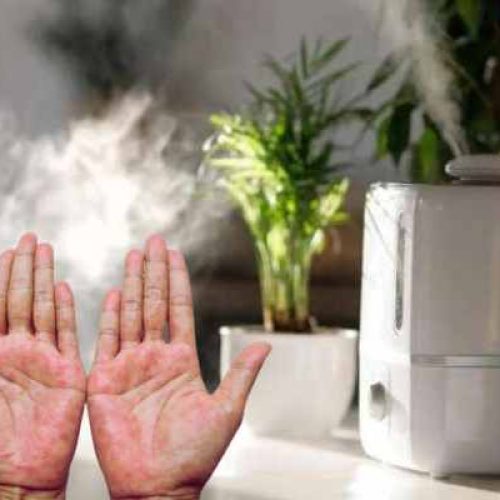 Do Air Purifiers Help with Eczema? The Definitive Guide